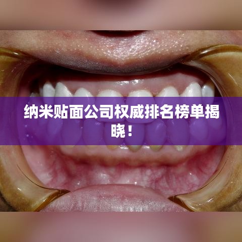 纳米贴面公司权威排名榜单揭晓！