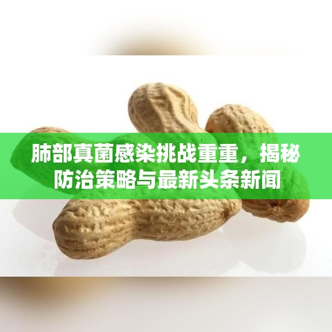 肺部真菌感染挑战重重,揭秘防治策略与最新头条新闻