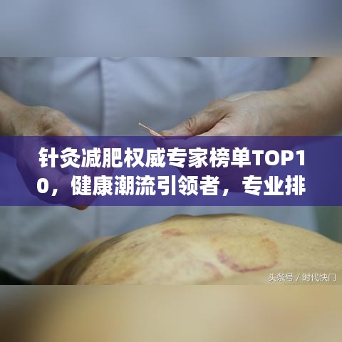 针灸减肥权威专家榜单TOP10,健康潮流引领者,专业排名助你选对名医!