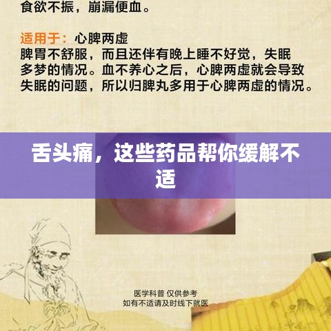 舌头痛，这些药品帮你缓解不适