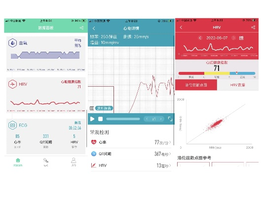 手环app官方下载与新版本血魔,实地数据验证设计&amp;尊贵版_v8.285